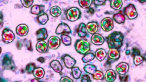 Another measles-related death reported in Pennsylvania as outbreak grows